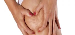 Bölgesel İncelme ve Selülit Tedavisinde Mezoterapi