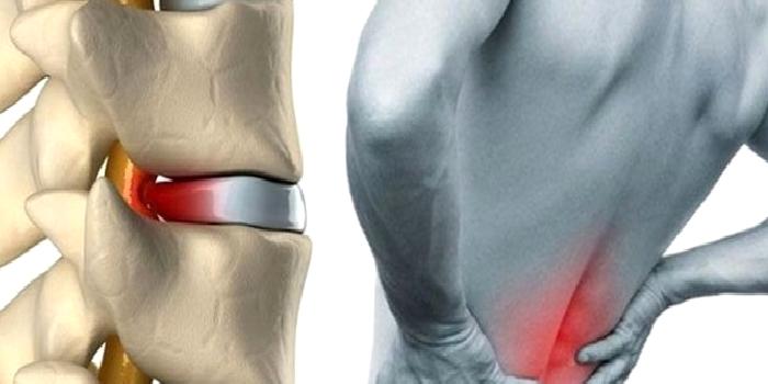 Boyun Ağrısı ve Nedenleri