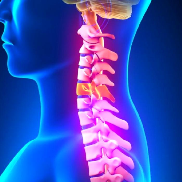 Boyun Fıtığı (Servikal Disk Hernisi)