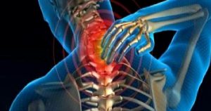 Boyun Omurgası Hastalıklarında Sık Yaşanan Şikayetler