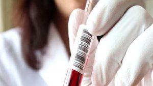BRCA Gen Testi Nedir?