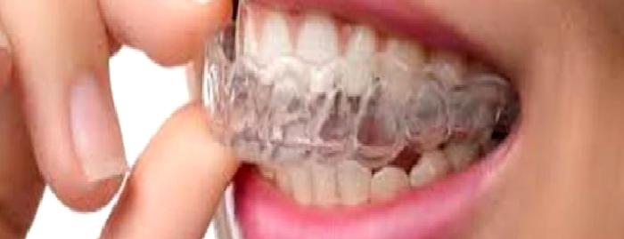 Bruksizm (diş gıcırdatma) nedir?