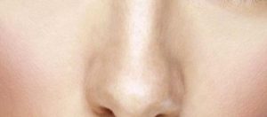 Burun Eğriliği Düzeltilmesi (Septorinoplasti)