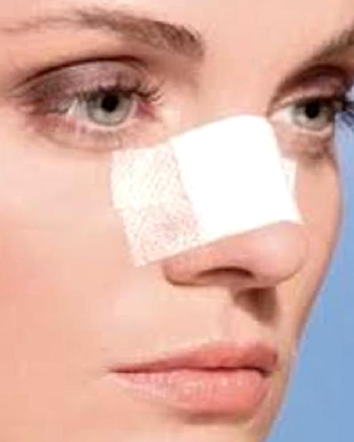 BURUN ESTETİĞİ SONRASI REVİZYON AMELİYATI GEREKLİ MİDİR?