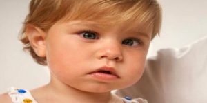 Çocuklarda Şaşılık