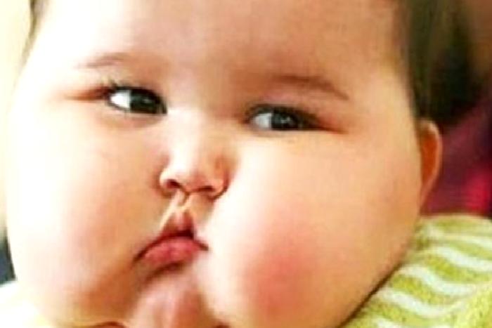 Çocukluk Çağı Obezite Çözümleri Programı