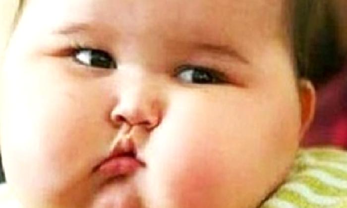 Çocukluk Çağı Obezite Çözümleri Programı
