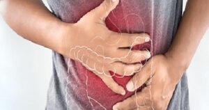 Crohn Hastalığı