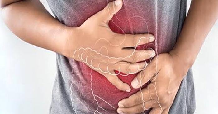Crohn Hastalığı