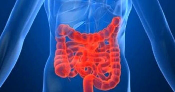 Crohn Hastalığı