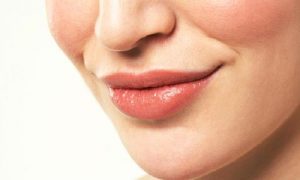 DAMAK YARIĞI AMELİYATI  &  DUDAK YARIĞI AMELİYATI