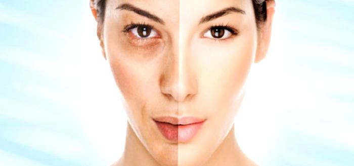 Dermapen ve Dermaroller