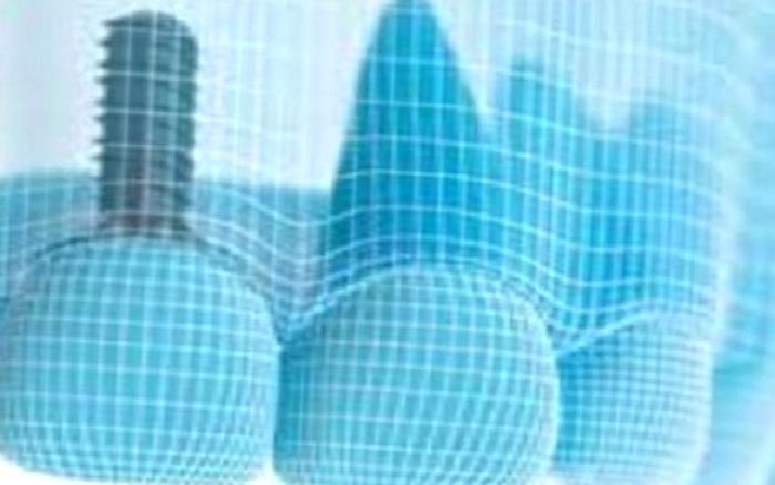 Dijital Diş Hekimliği