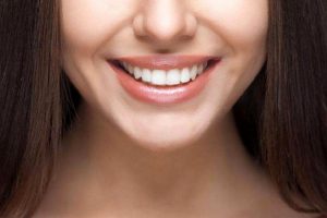 Diş Beyazlatma Yöntemleri