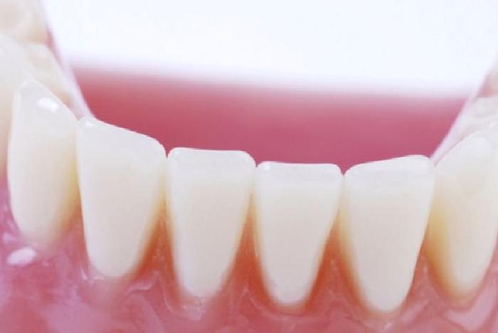 Diş Eti Çekilmeleri