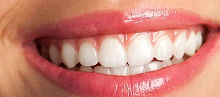 Diş Eti Rahatsızlığı İçin Lazer Tedavisi