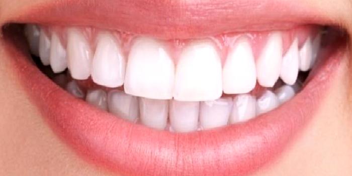 Diş Eti Sağlığı ve Doğru Bildiğimiz Yanlışlar