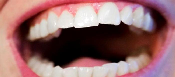 Diş Hakkında Bilgiler