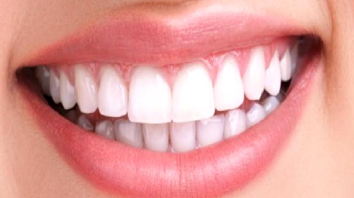 Diş Renklenmeleri ve Beyazlatma