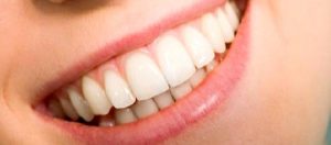 Dişeti Çekilmesi Nedir? Sebepleri, Sonuçları Nelerdir? Tedavisi Mümkün Mü?