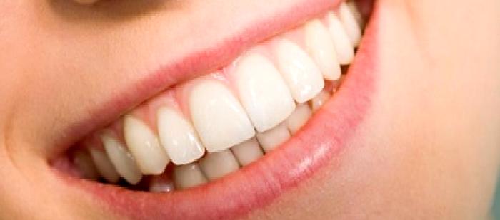 Dişeti Çekilmesi Nedir? Sebepleri, Sonuçları Nelerdir? Tedavisi Mümkün Mü?