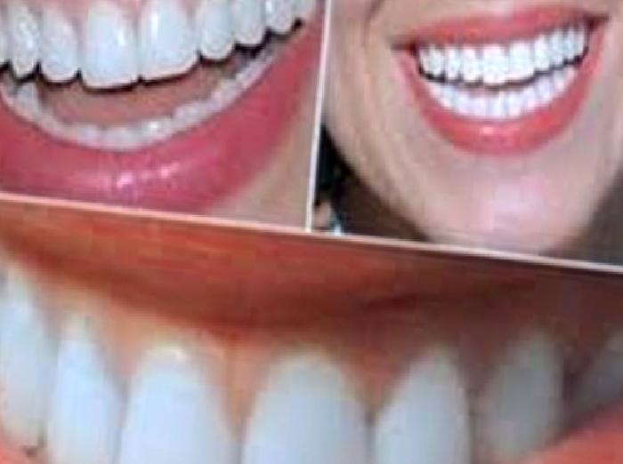 Dişeti hastalığınız varsa, bazı kanser türleri için risk grubundasınız!