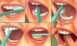 Dişler Nasıl Fırçalanır?