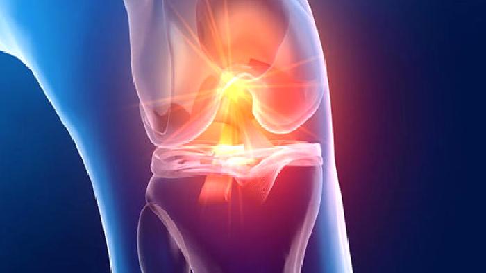 Diz Kayması (Patellar Dislokasyon)
