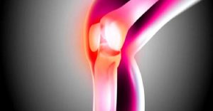 Dizde Bağ Yaralanmaları