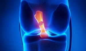 DOĞUM KONTROL HAPLARI ÖN ÇAPRAZ BAĞ YARALANMA OLASILIĞINI AZALTIYOR