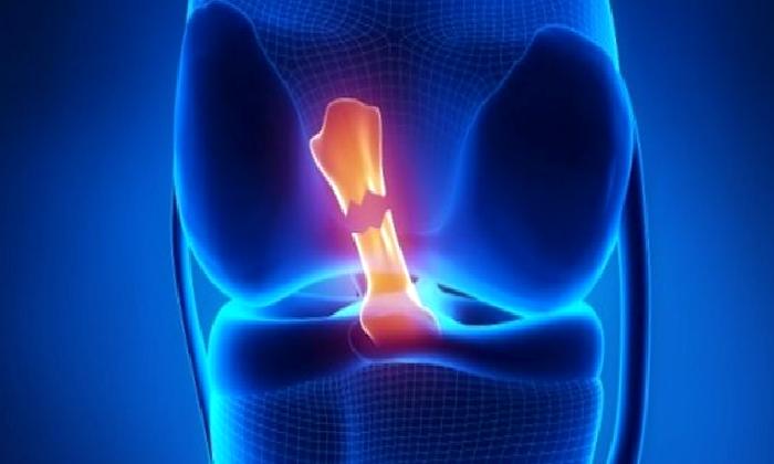 DOĞUM KONTROL HAPLARI ÖN ÇAPRAZ BAĞ YARALANMA OLASILIĞINI AZALTIYOR