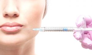 DUDAK DOLGUSU ve KALICILIK