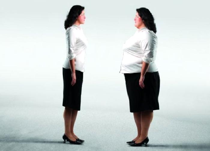 Eklem Ağrıları ve Obezite Cerrahisi