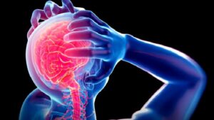 Epilepsi (Sara Hastalığı)