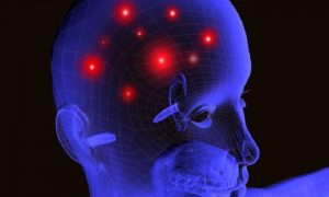 Epilepside  Öneriler