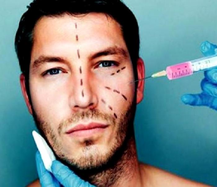 Erkek Burun Estetiği