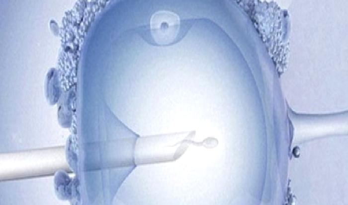 Erkekten canlı sperm elde etme yöntemleri