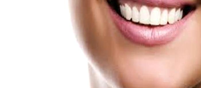 Estetik Amaçla Diş Tedavisine Karar Veren Bir Kişinin Aklından Geçenler