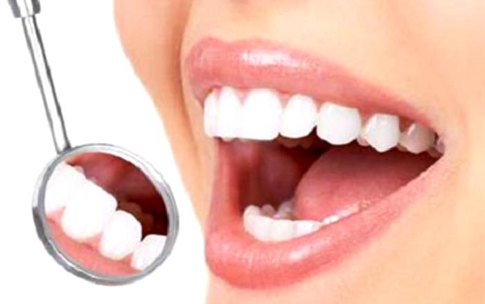 Estetik Diş Dolguları