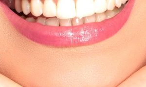 Estetik Diş Hekimliği