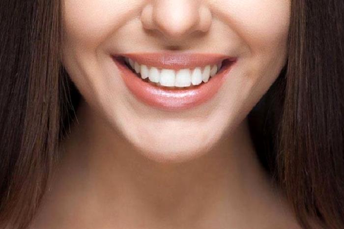 Estetik Diş Hekimliği ve Gülüş Tasarımı