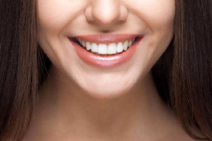 Estetik Diş Hekimliği