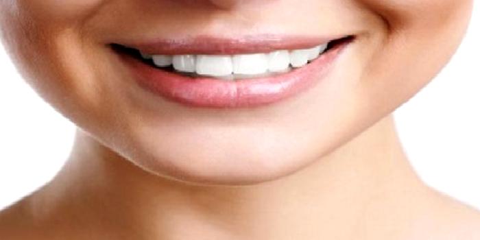 Estetik Gülüş Diş Tasarımı