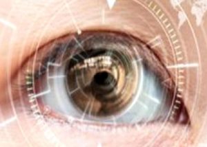 Excimer Lazer Nedir?