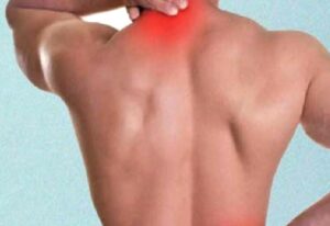 Fibromiyalji Nedir?