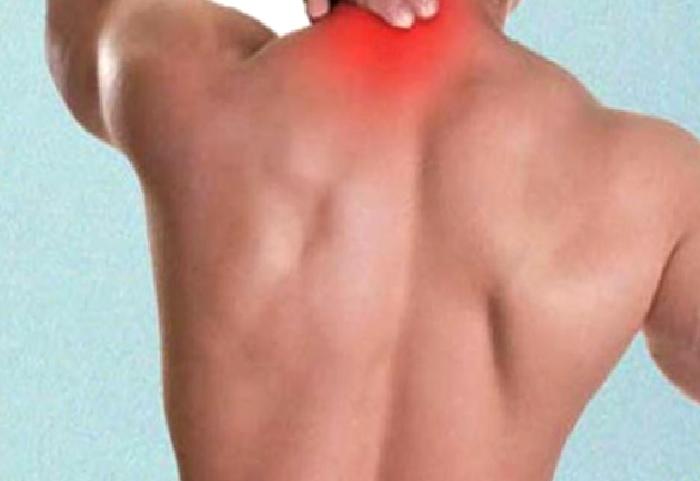 Fibromiyalji Sendromu