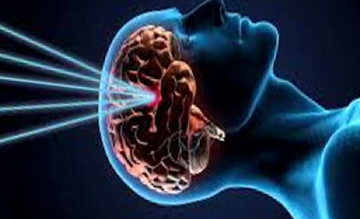 Gamma Knife Radyocerrahisi