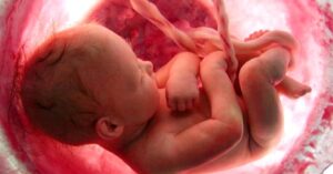 GEBELiKTE KAN PIHTILAŞMA EĞİLİMİ VE RİSKLERİ