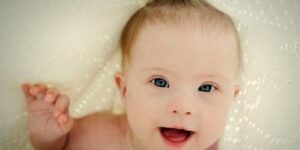 Genetik Hastalıklar