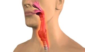 Geniz Eti Ameliyatı